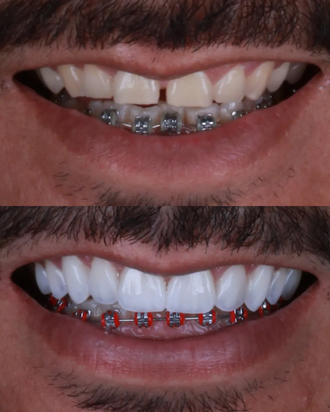 Antes e depois de tratamento odontológico