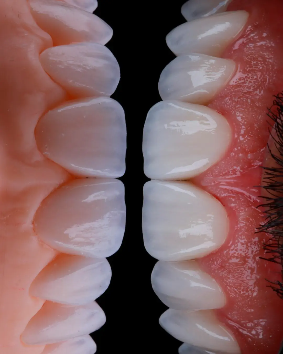 Detalhes técnicos do tratamento odontológico